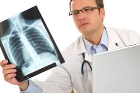 Expert medical opinion required for bone cancer diagnose