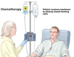 Chemotherapy: cancer treatment